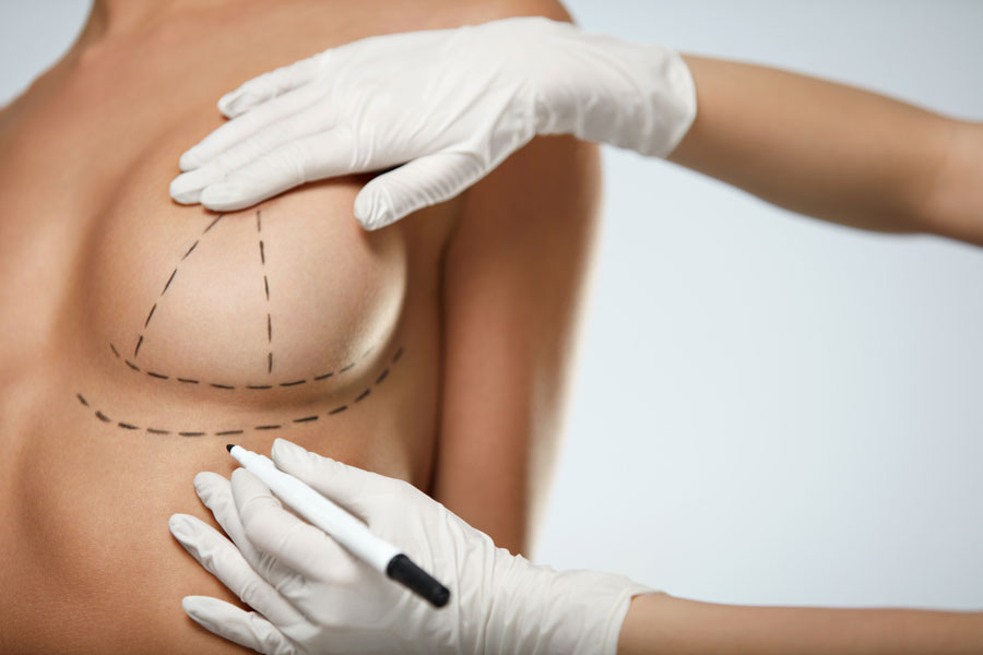 breast lift without surgery