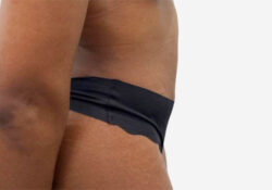 Tummy Tuck